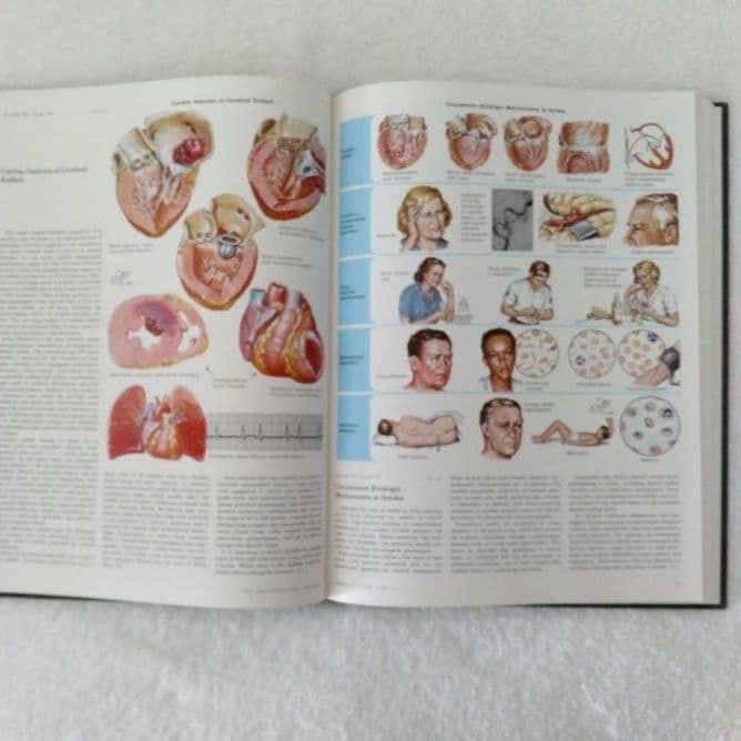 洋書 ・希少 CIBA医学イラスト集第1巻 Ⅱ フランクH.ネッター／英語版