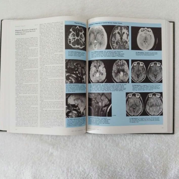 洋書 ・希少 CIBA医学イラスト集第1巻 Ⅱ フランクH.ネッター／英語版