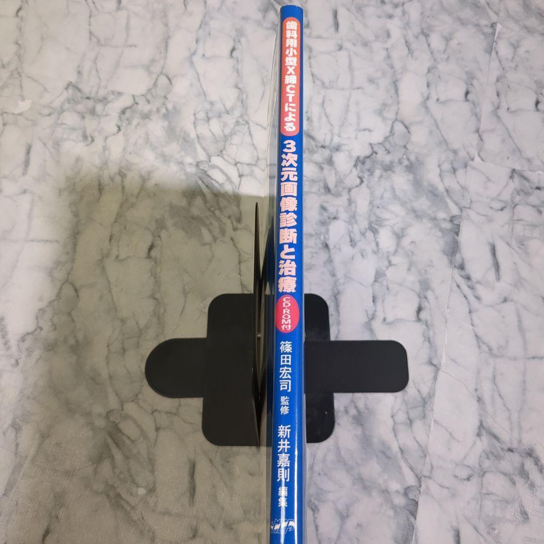 歯科用小型X線CTによる3次元画像診断と治療