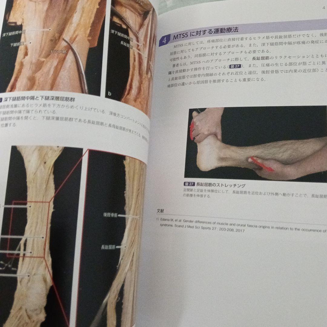 運動療法　その前に！運動器の臨床解剖アトラス