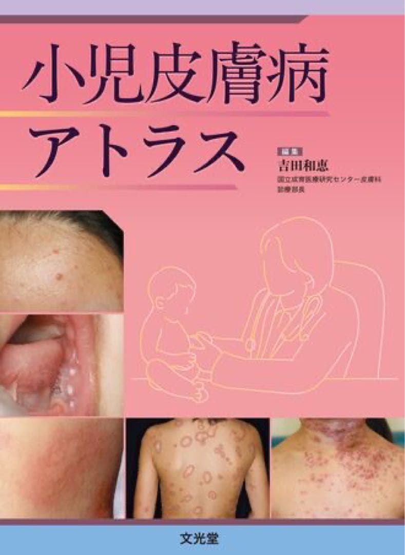 小児皮膚病アトラス