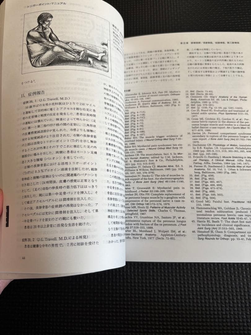 トリガーポイント・マニュアル 第IV巻　美品