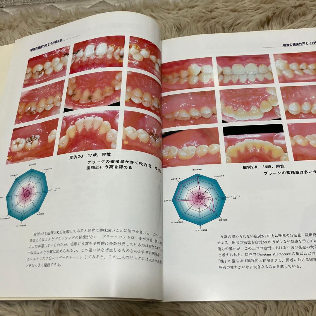 クリニカルカリオロジー = Clinical cariology