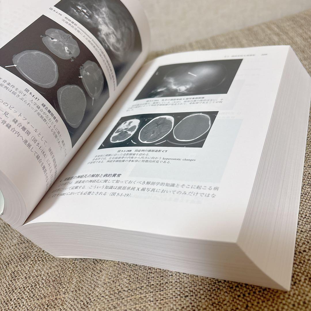 脳神経外科学 改訂11版　金芳堂