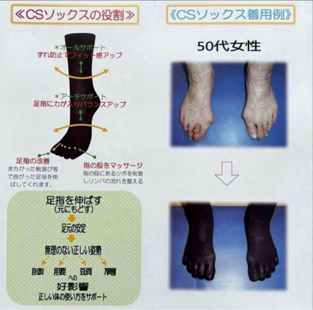 CSソックス 58 コンプレッション ダブルロング丈 M ブラック 2足