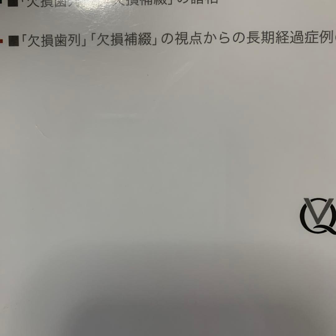 見る目が変わる!「欠損歯列」の読み方,「欠損補綴」の設計