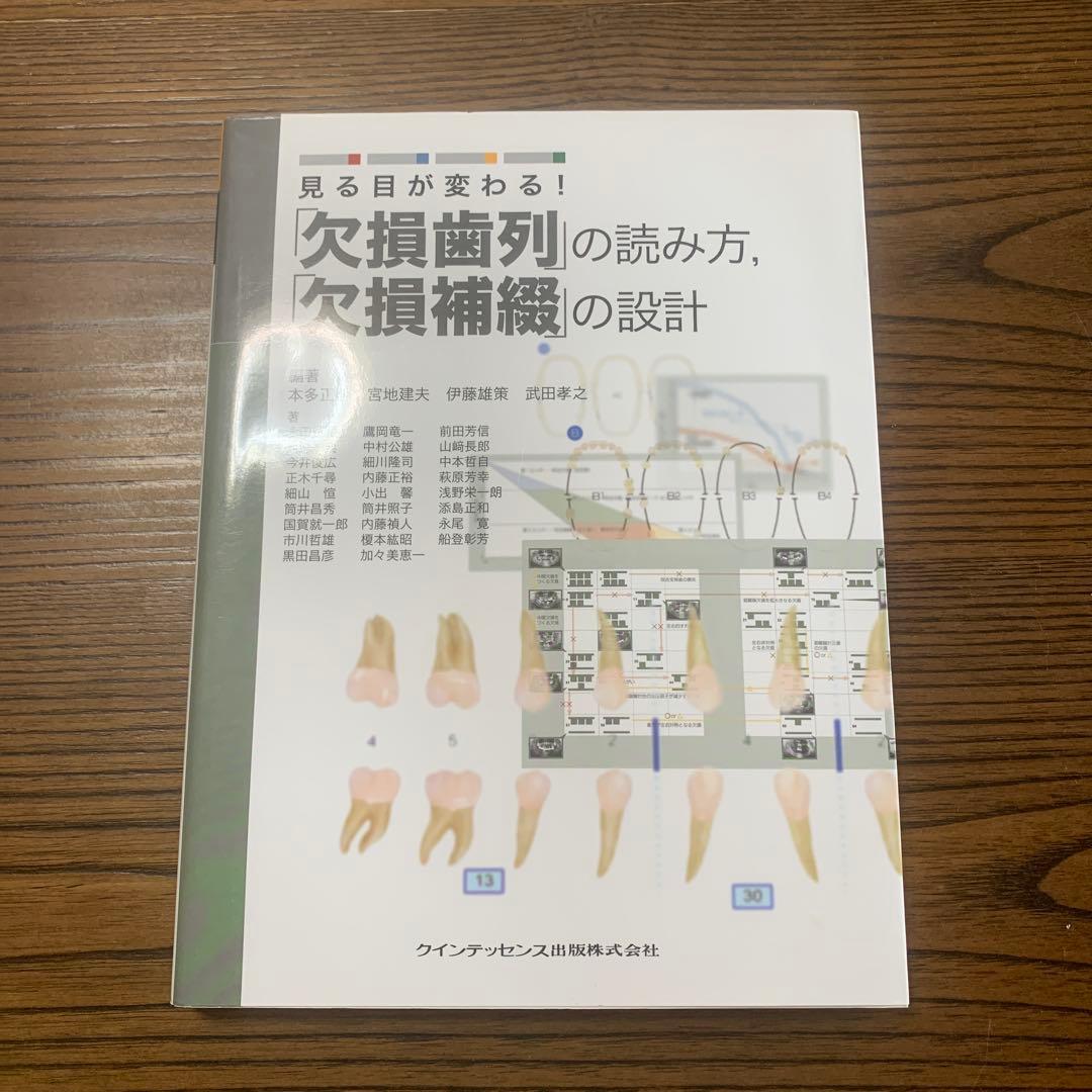 見る目が変わる!「欠損歯列」の読み方,「欠損補綴」の設計