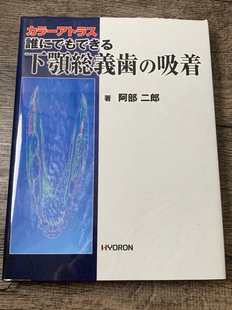 最終値下げ 誰にでもできる下顎総義歯の吸着 : カラーアトラス