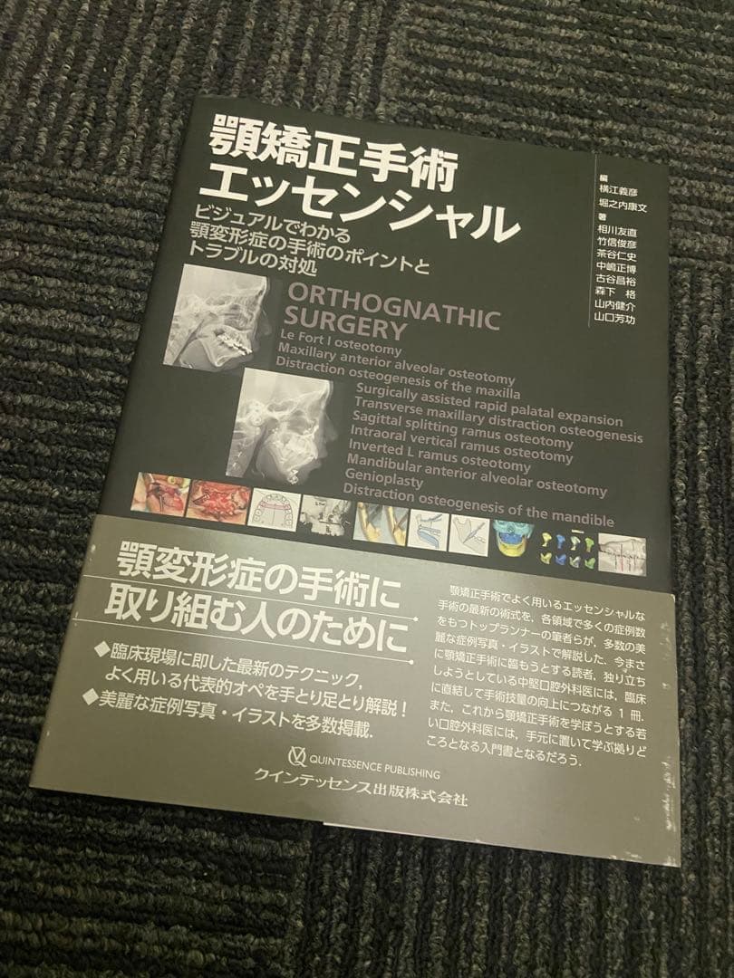 顎矯正手術エッセンシャル