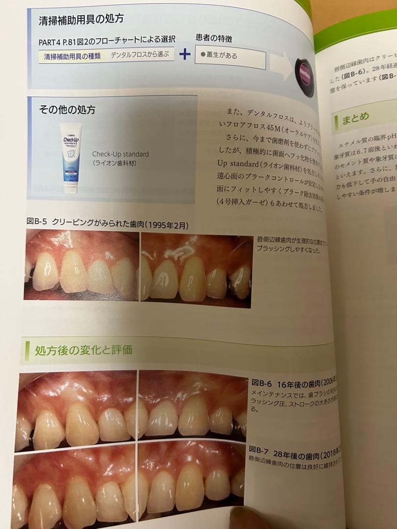 歯ブラシ処方箋