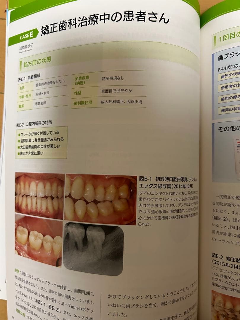 歯ブラシ処方箋