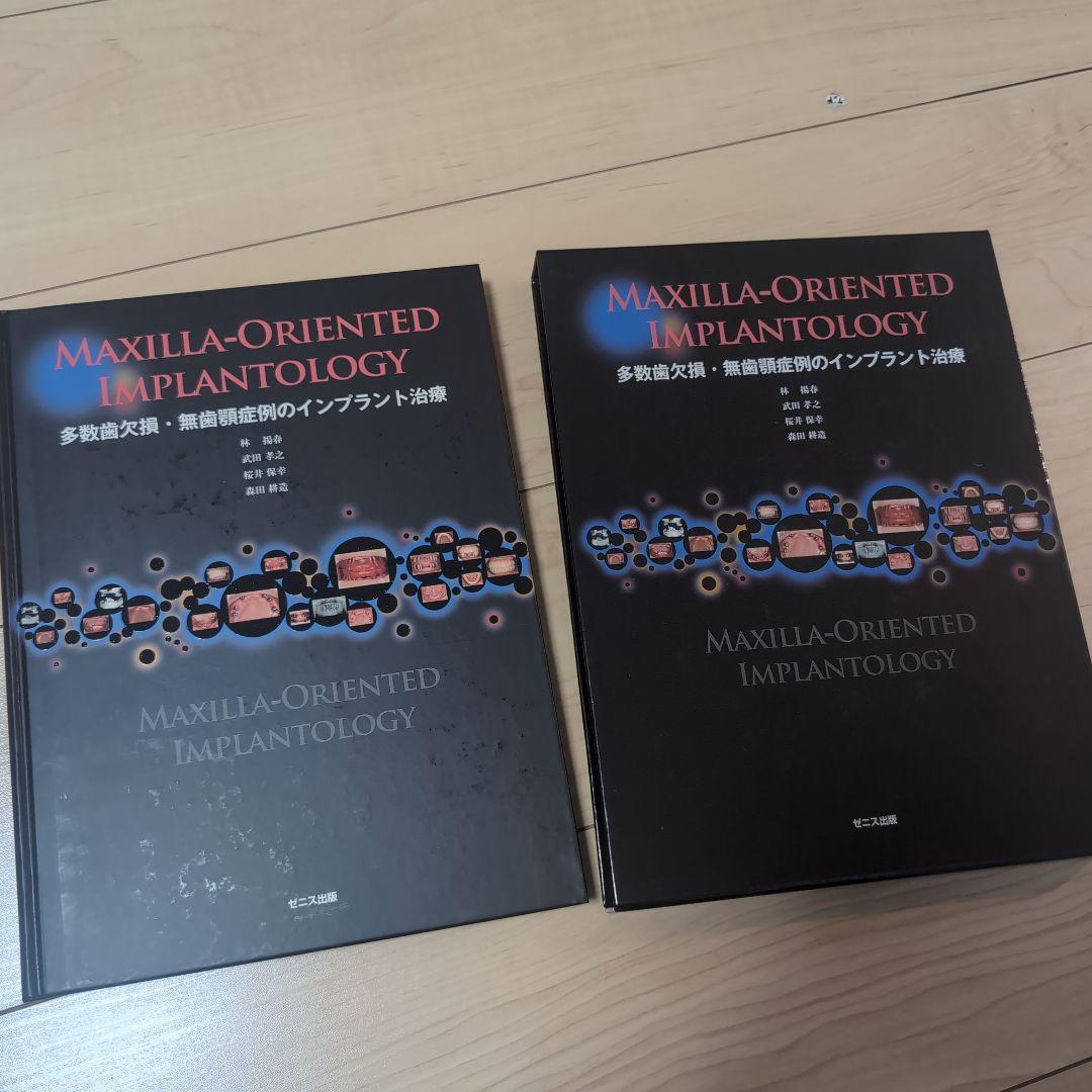 多数歯欠損・無歯顎症例のインプラント治療