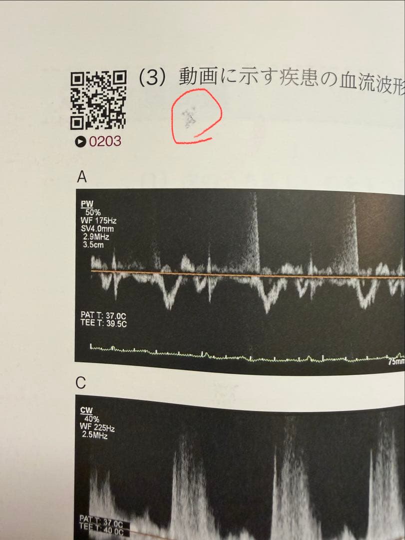 中外医学社 TEE試験対策ガイド JB POT 心エコー図専門医試験徹底攻略