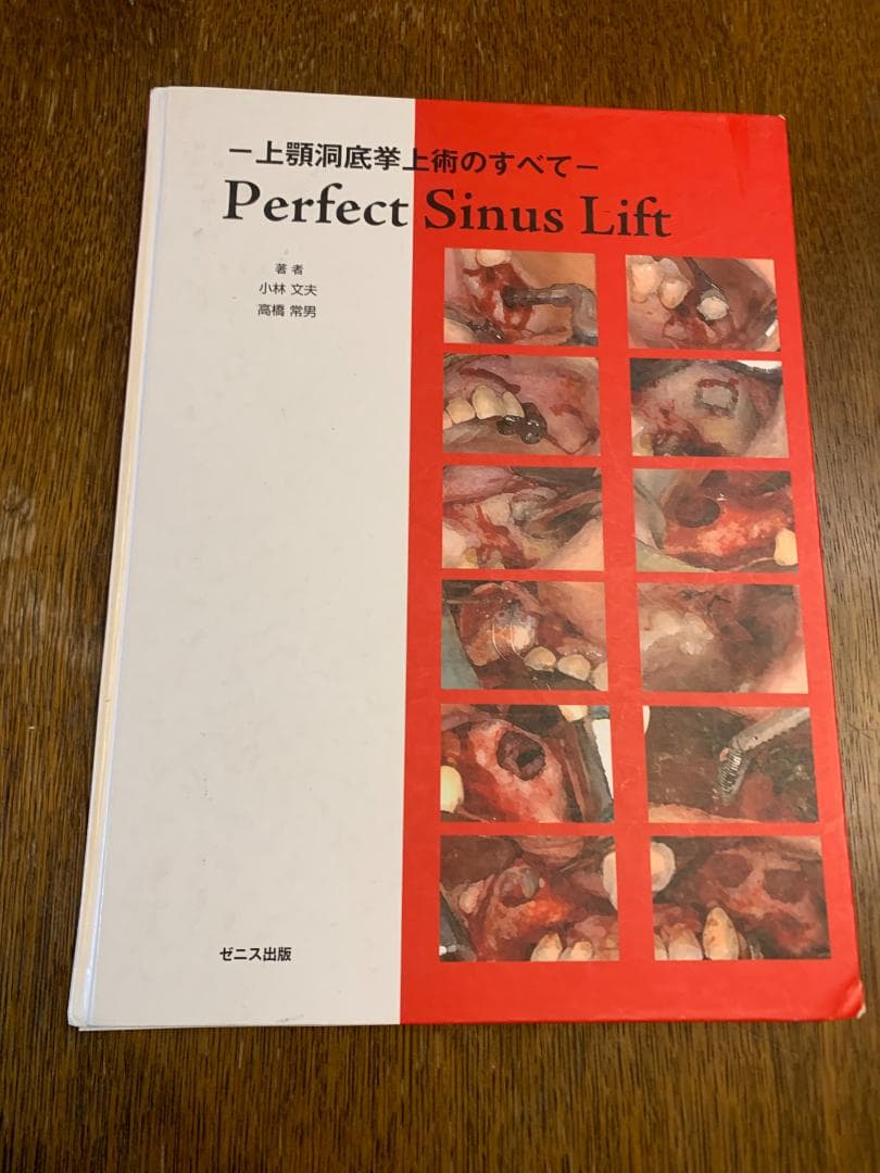 【裁断済・希少】Perfect Sinus Lift ―上顎洞底挙上術のすべて―