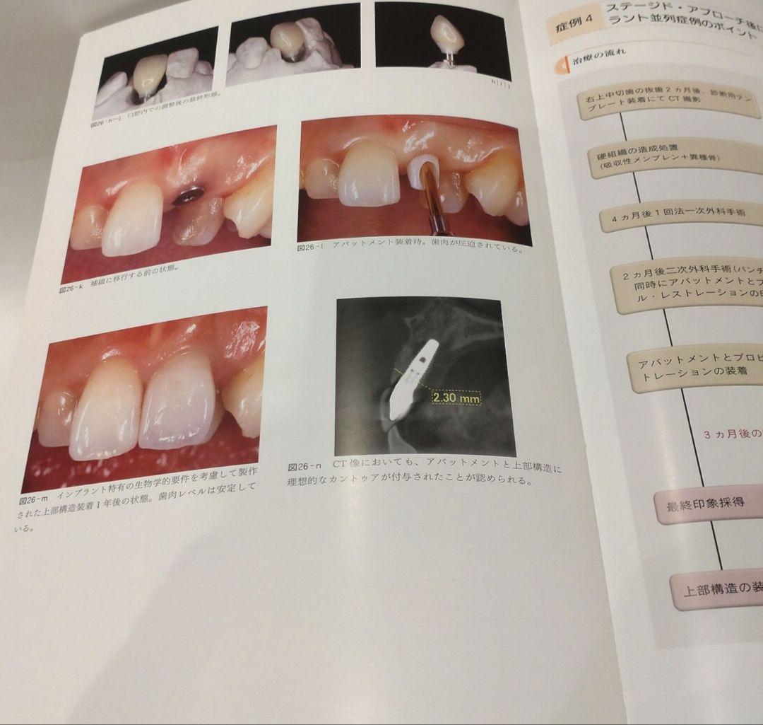 前歯部審美修復 チェアサイド・テクニック編 小濱忠一 歯科 治療 DVD 本