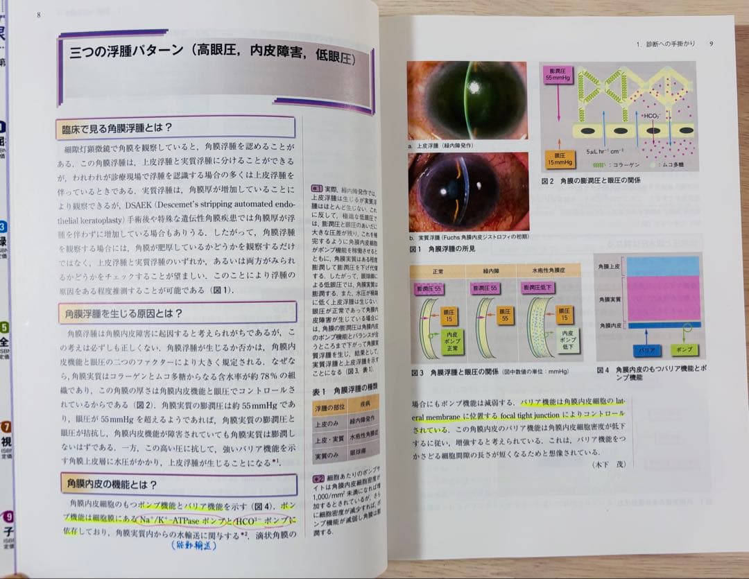 【一部書き込み有】眼科診療クオリファイ 角膜内皮障害 to the Rescue