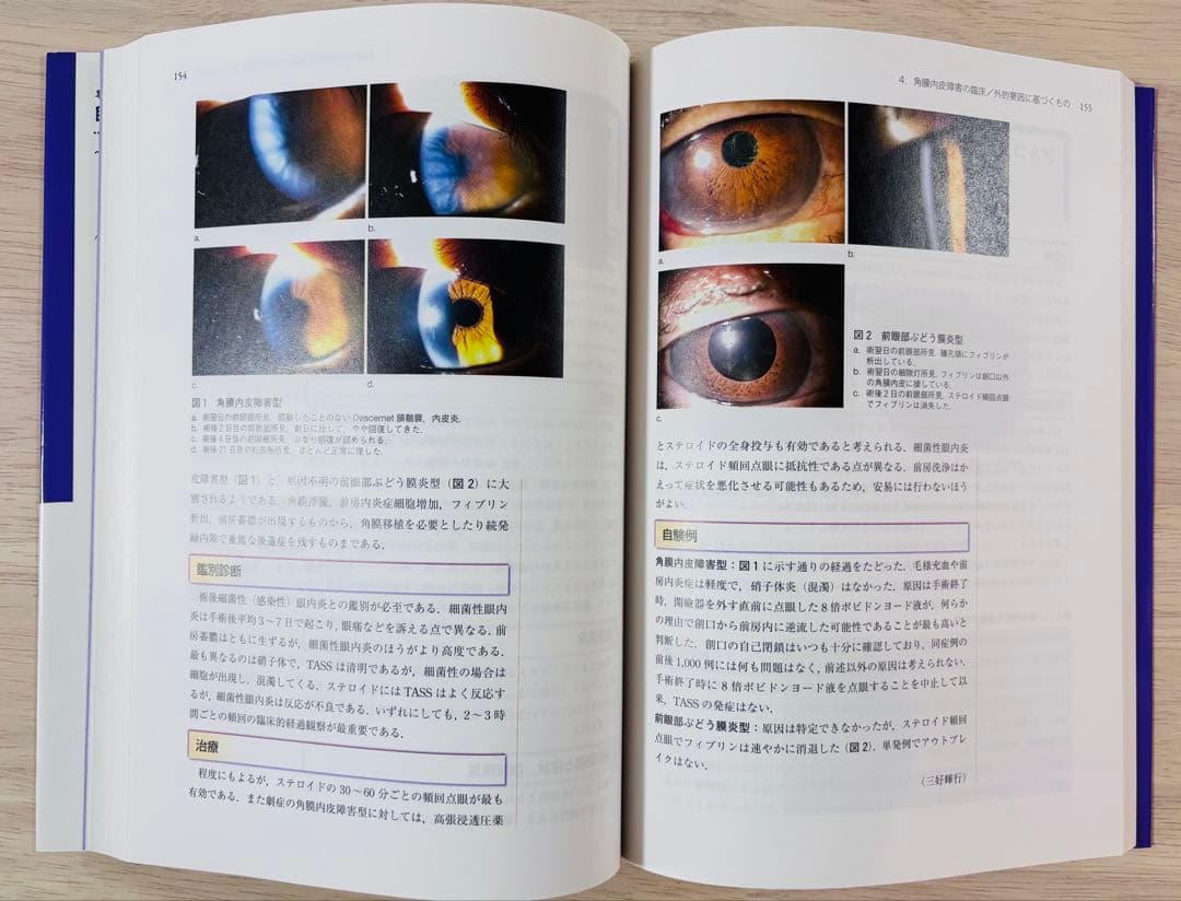 【一部書き込み有】眼科診療クオリファイ 角膜内皮障害 to the Rescue