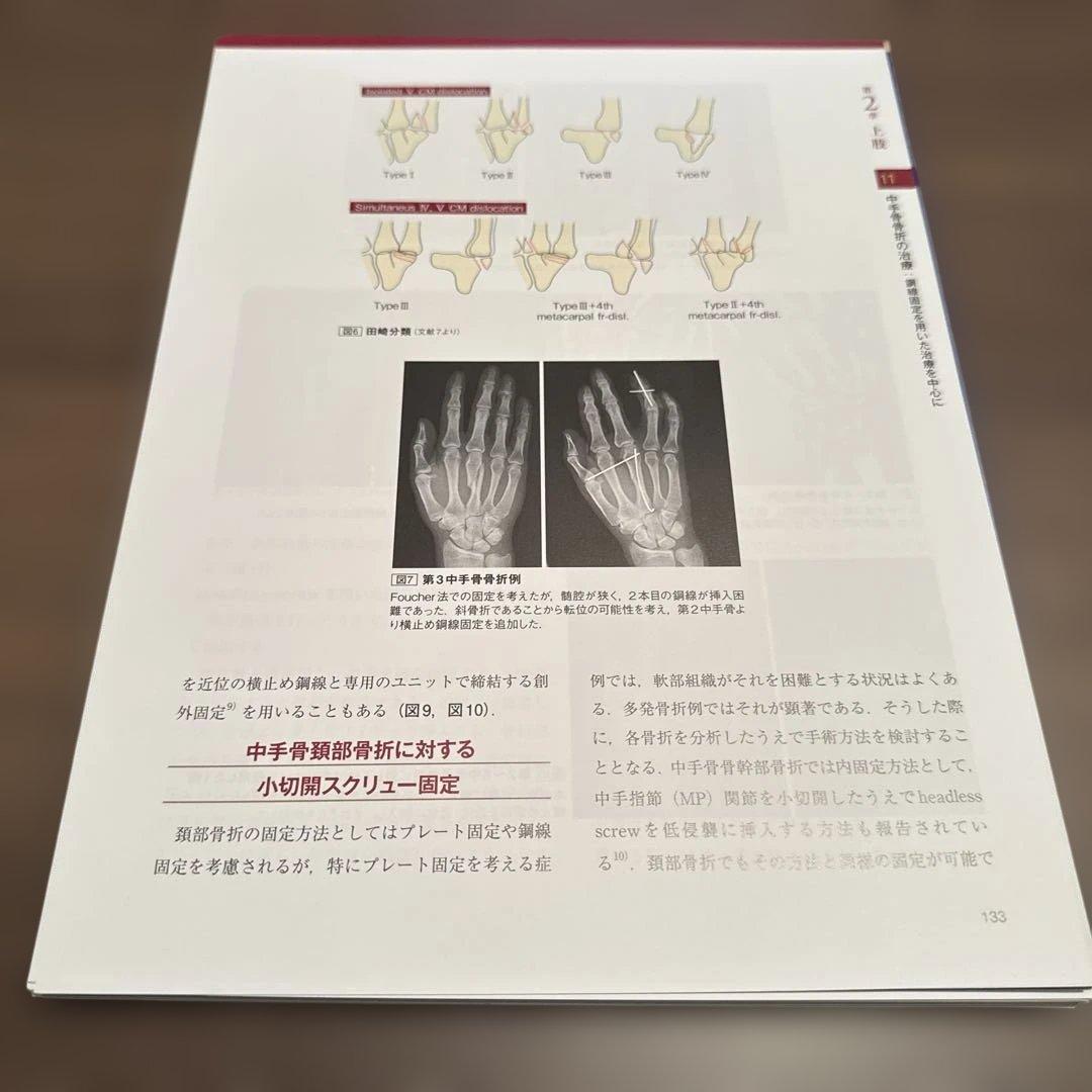 骨折のピンニングと経皮的スクリュー固定 : 経皮テクニック完全攻略