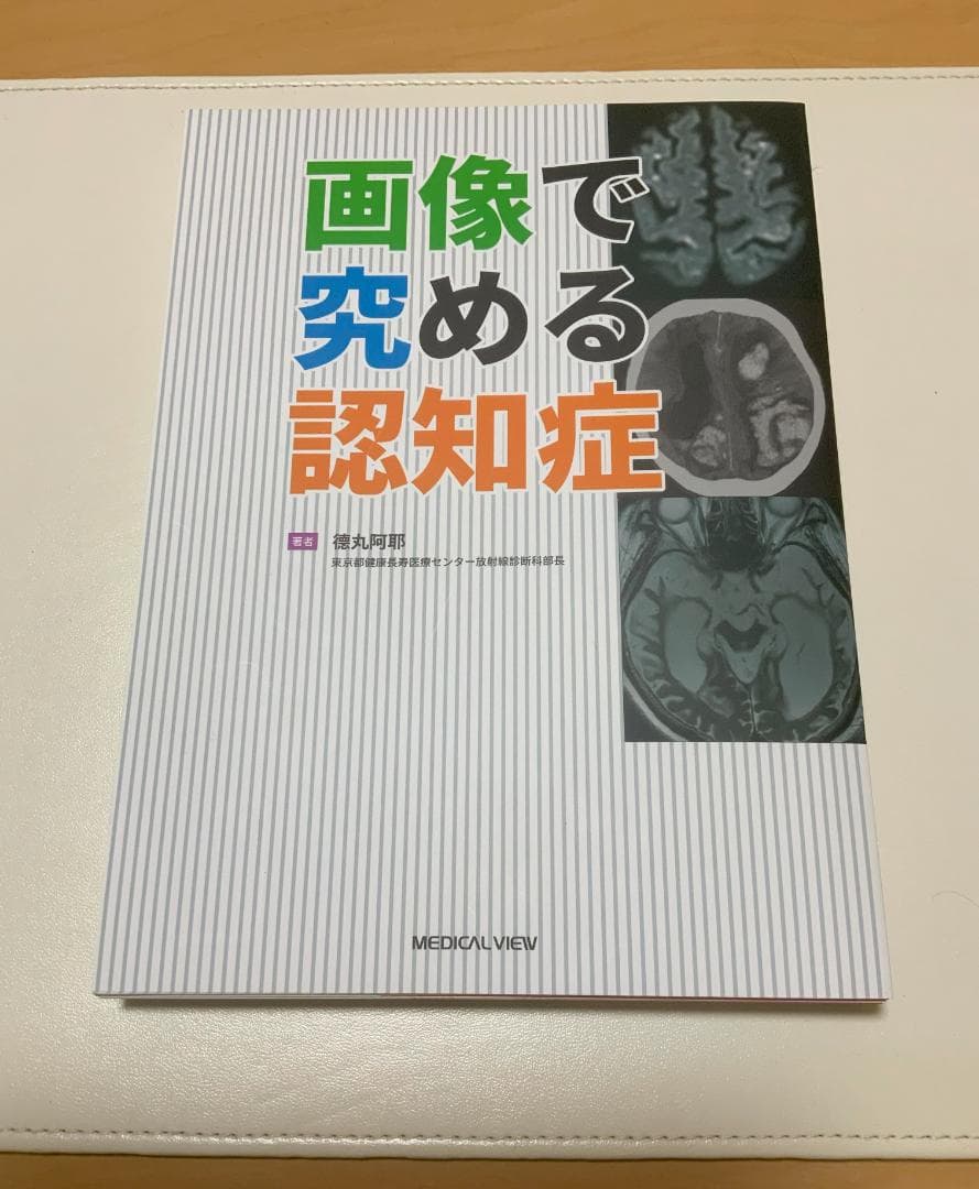 【裁断済】画像で究める認知症
