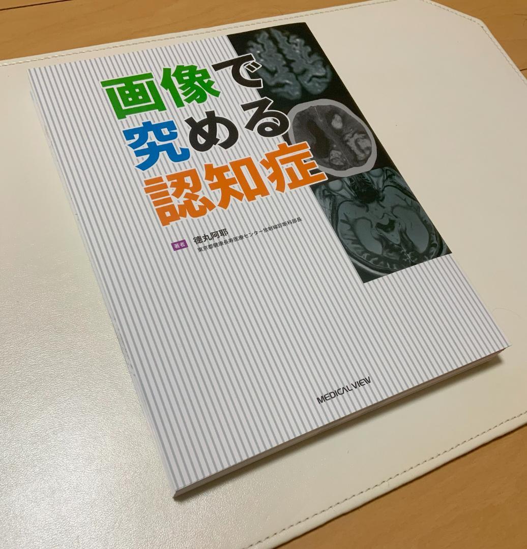 【裁断済】画像で究める認知症