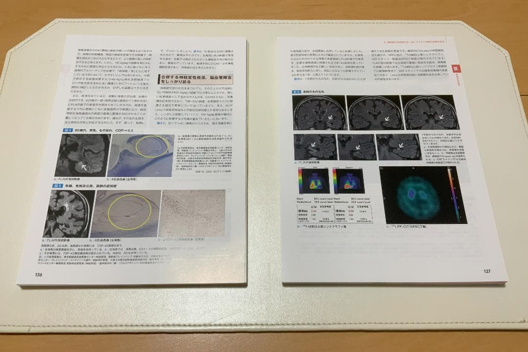 【裁断済】画像で究める認知症