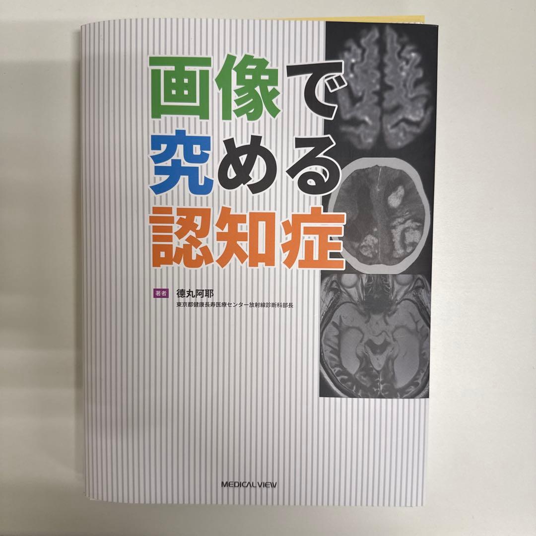 【裁断済】画像で究める認知症