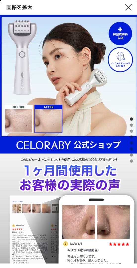 PENTA-SHOT 美顔器 USB充電式