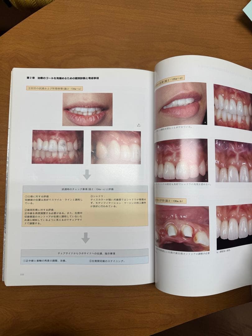 前歯部審美修復　天然歯編　小濵忠一著