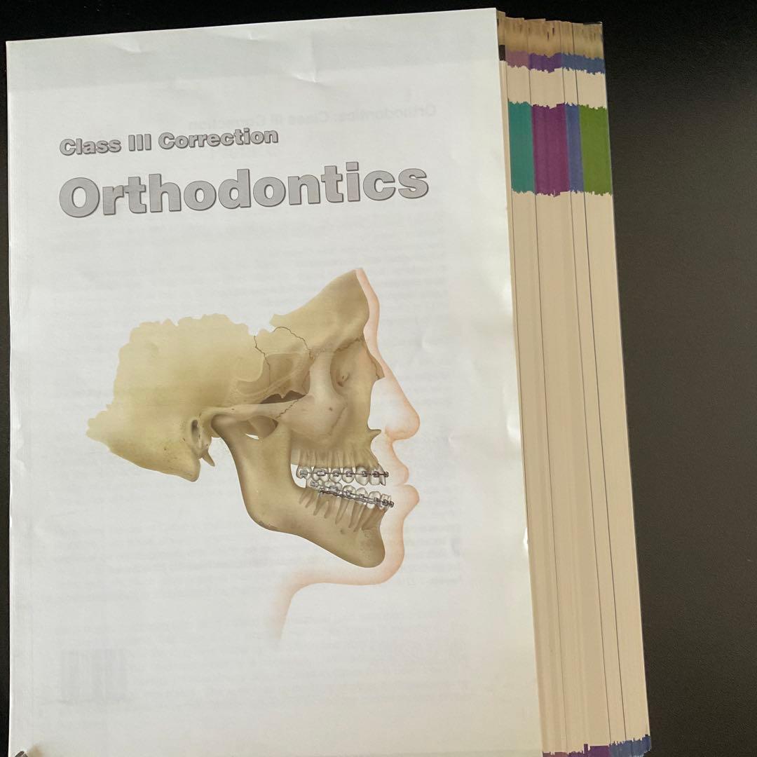 健康・医学 269 Class III Correction Orthodontics