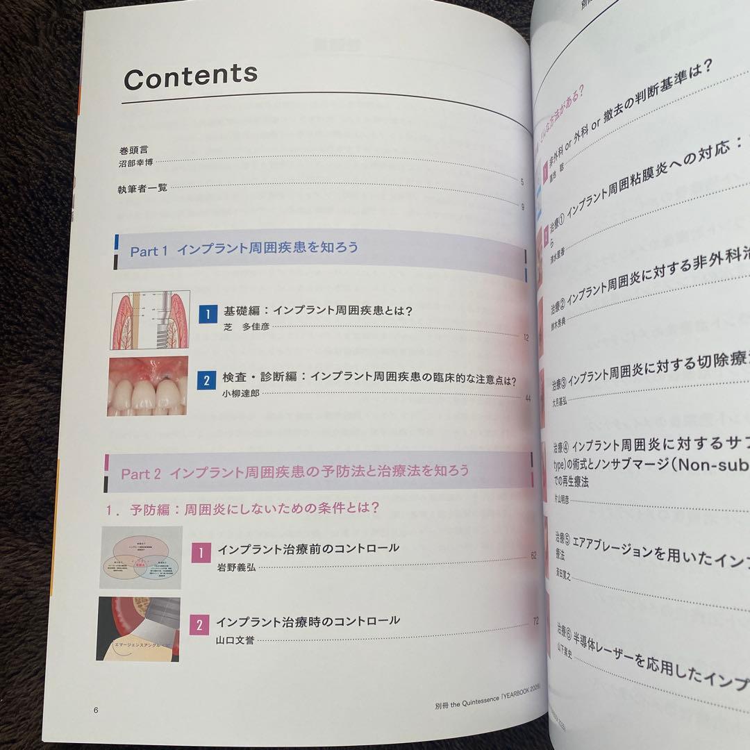 別冊.ザクインテッセンス インプラント周囲疾患対応ビジュアルガイド