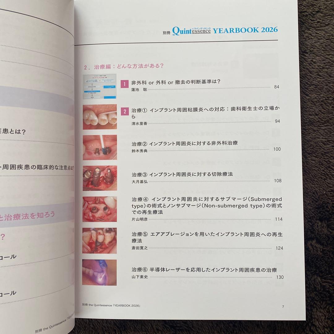 別冊.ザクインテッセンス インプラント周囲疾患対応ビジュアルガイド