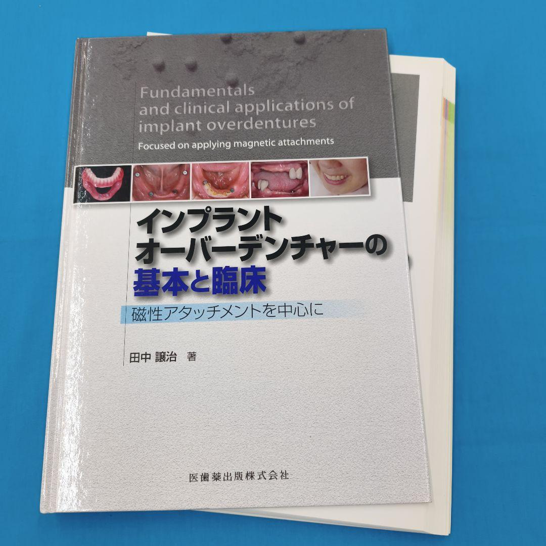 ♣裁断済 インプラントオーバーデンチャーの基本と臨床