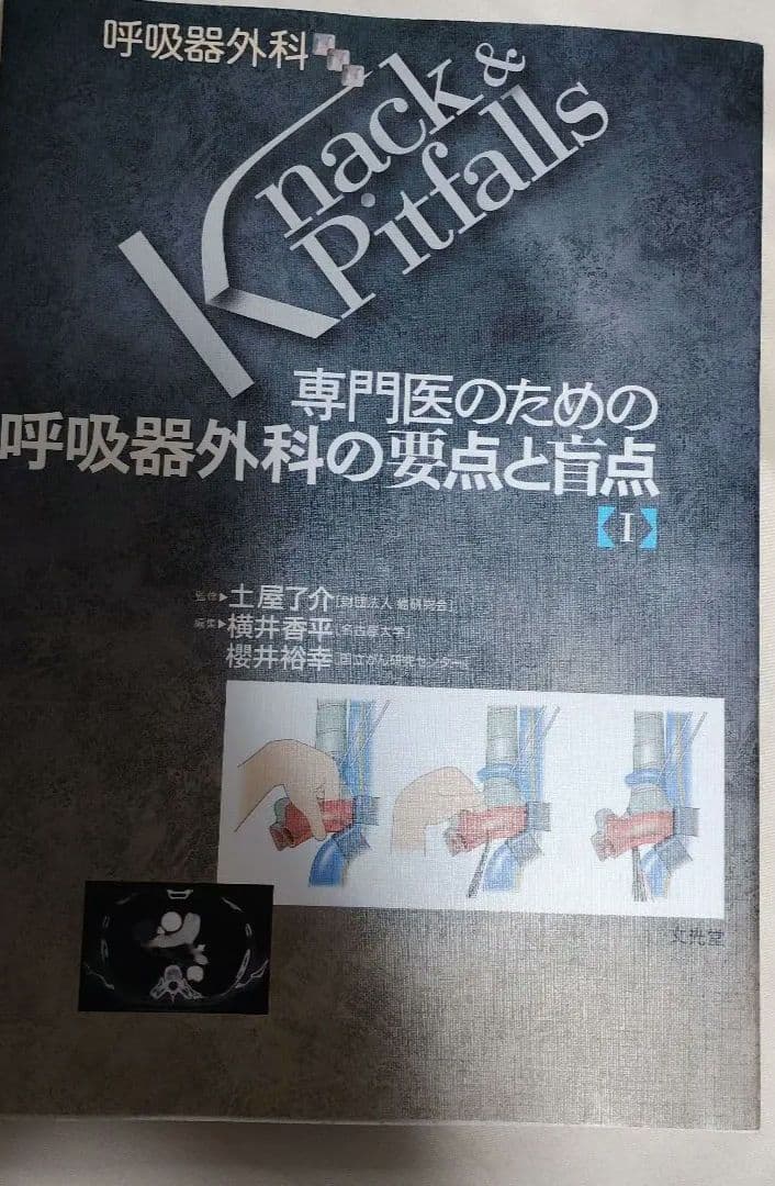 Knack & Pitfalls 呼吸器外科の要点と盲点 [1]