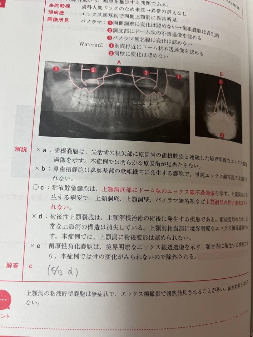 値段交渉可 麻布デンタルアカデミー出版歯科医師国試過去問集実践2023全冊セット