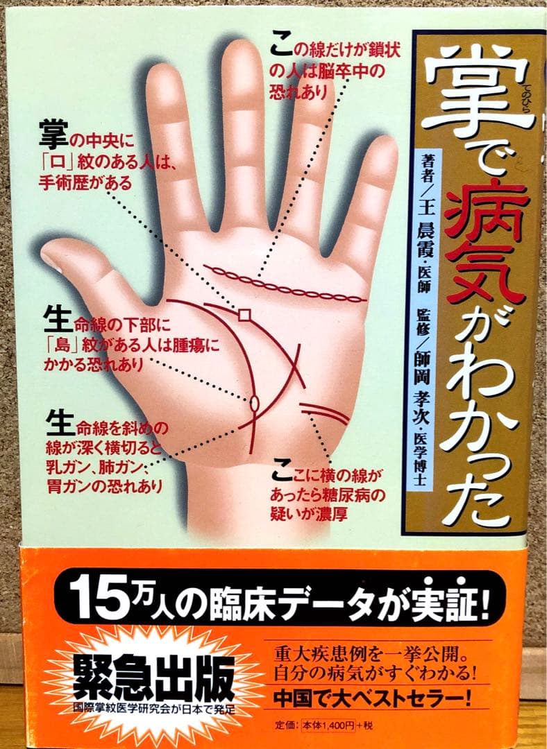 【レア物】掌で病気がわかった　15万人の臨床データが実証！