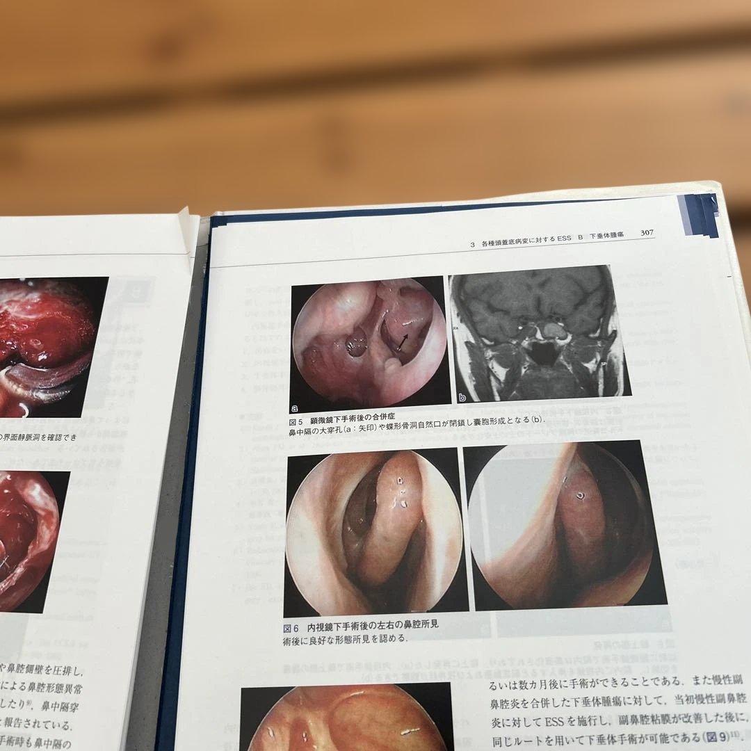 内視鏡下鼻内副鼻腔手術[DVD付] 副鼻腔疾患から頭蓋底疾患まで