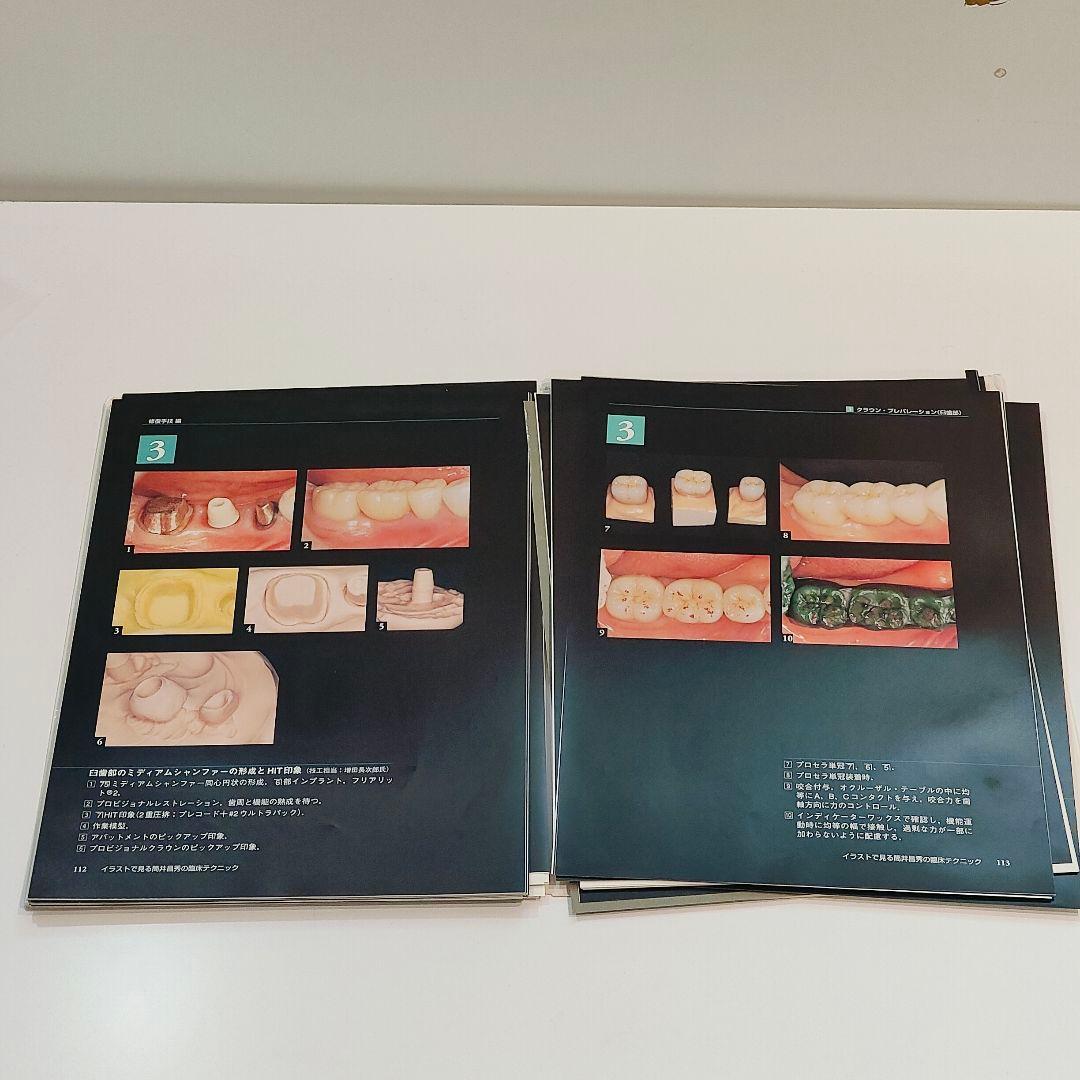 【裁断済】イラストで見る筒井昌秀の臨床テクニック