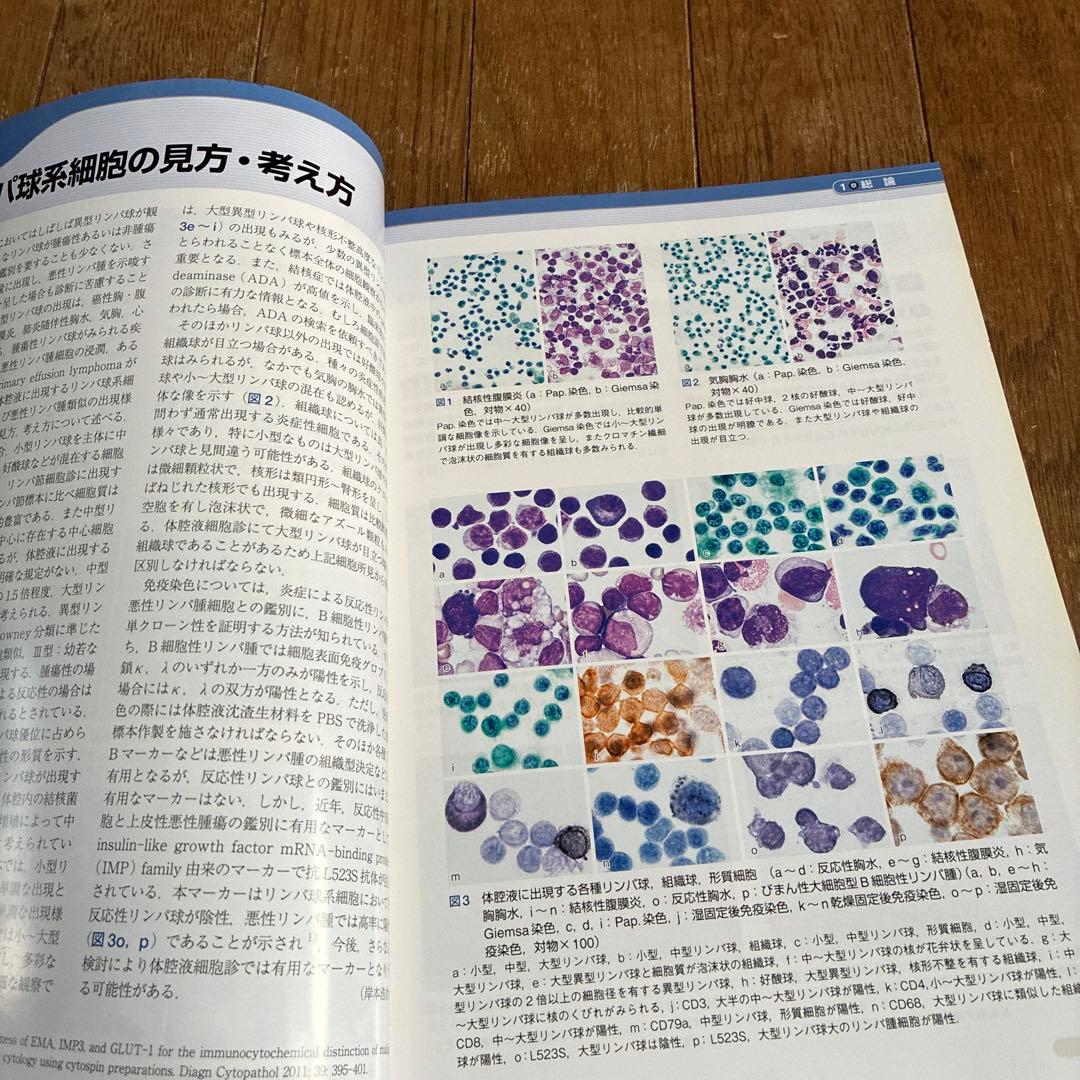 体腔液細胞診カラーアトラス　文光堂　診断へのアプローチ