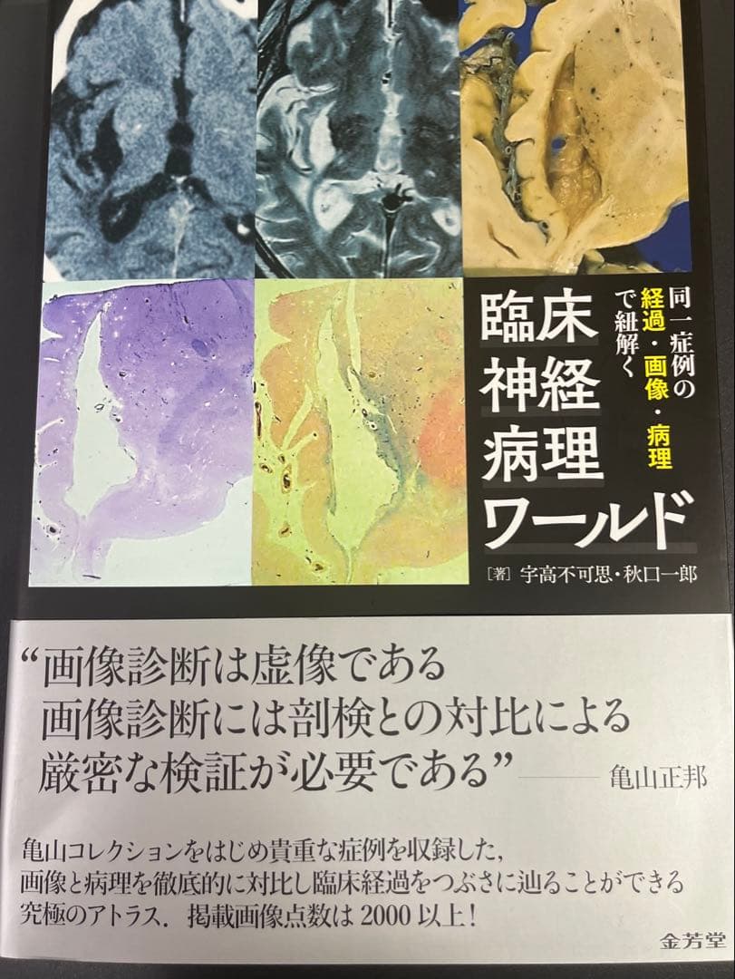 同一症例の経過・画像・病理で紐解く臨床神経病理ワールド　値下げしました