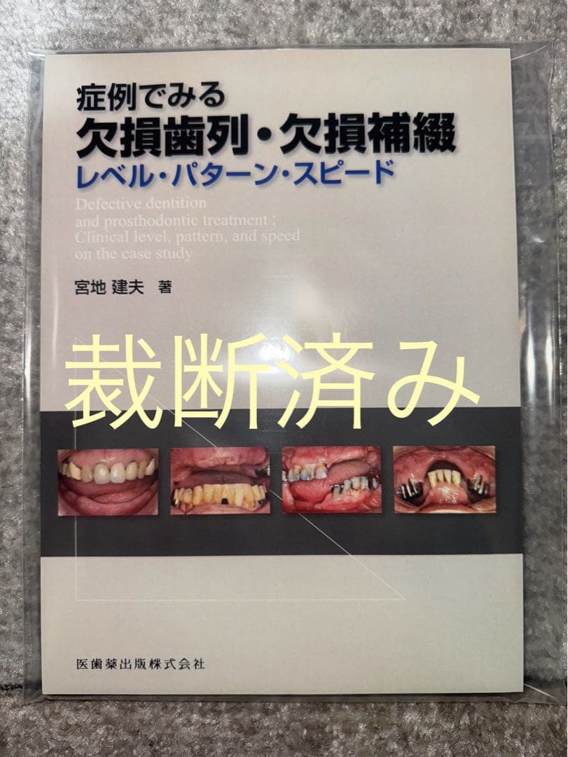 【裁断済み】症例でみる欠損歯列・欠損補綴　レベル・パターン・スピード