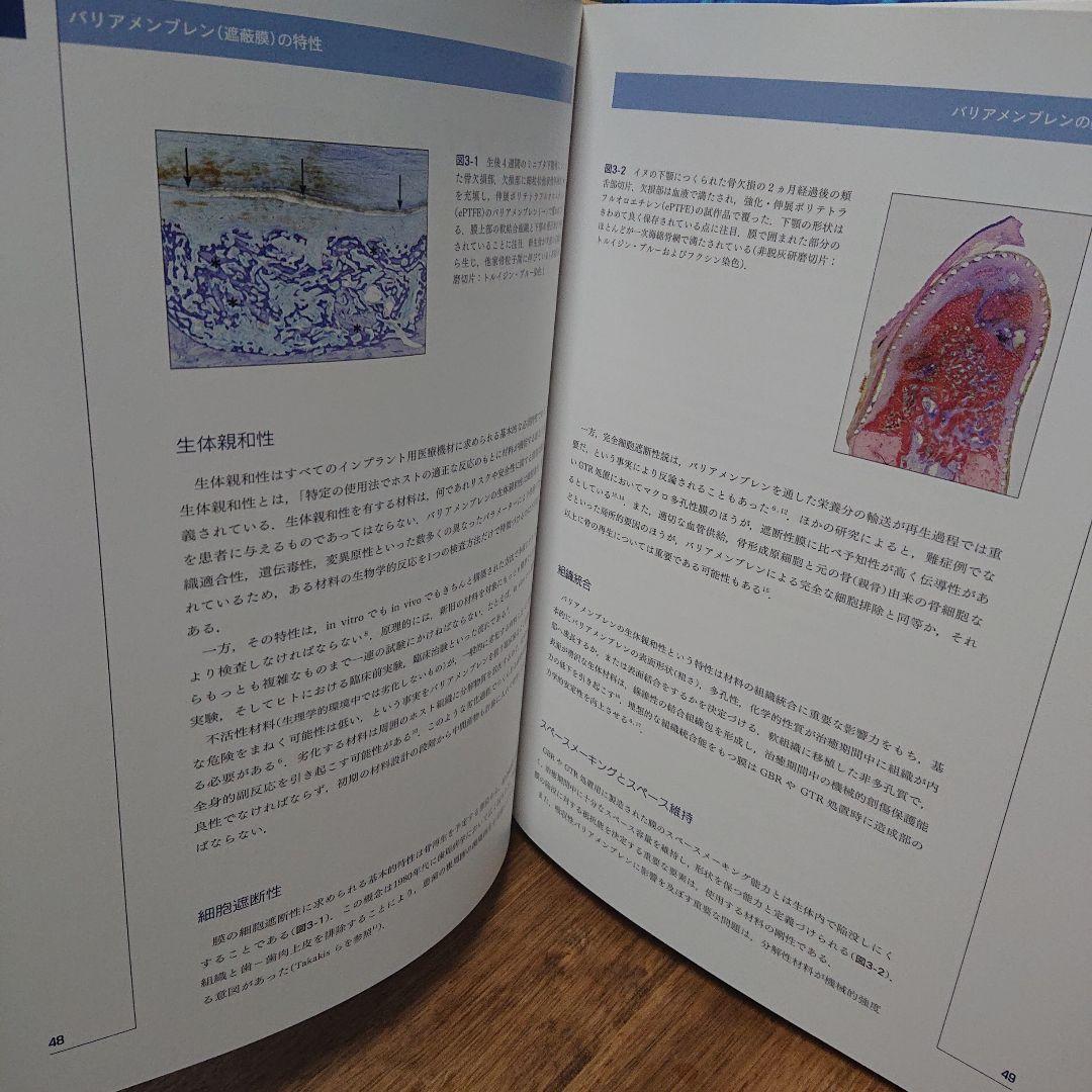 インプラント歯科における骨再生誘導法の20年