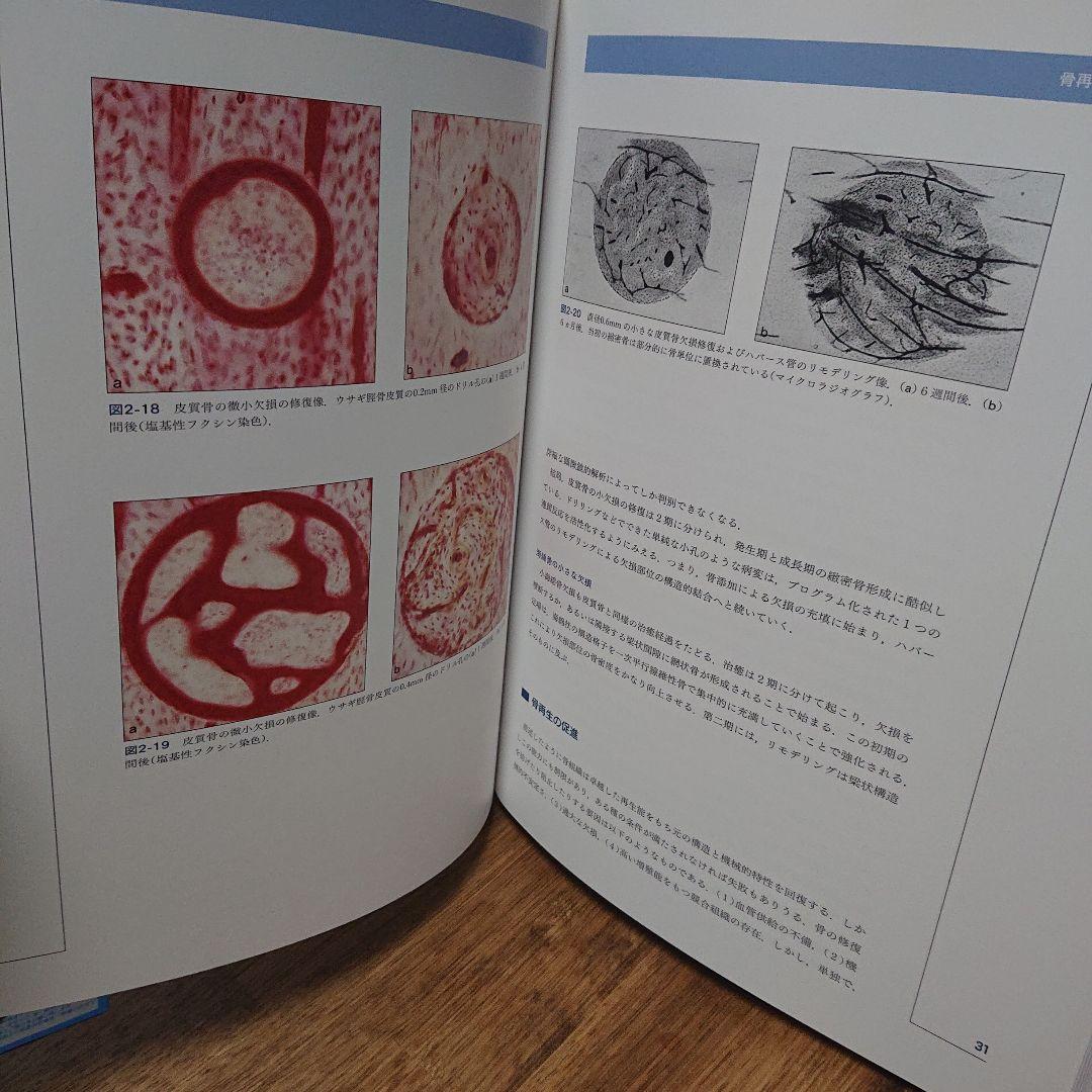 インプラント歯科における骨再生誘導法の20年