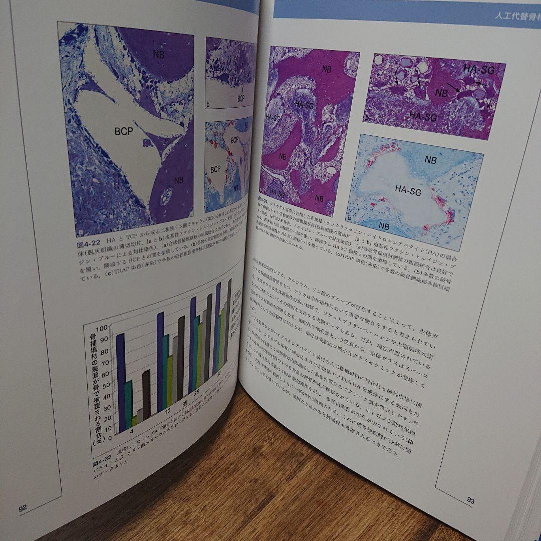 インプラント歯科における骨再生誘導法の20年