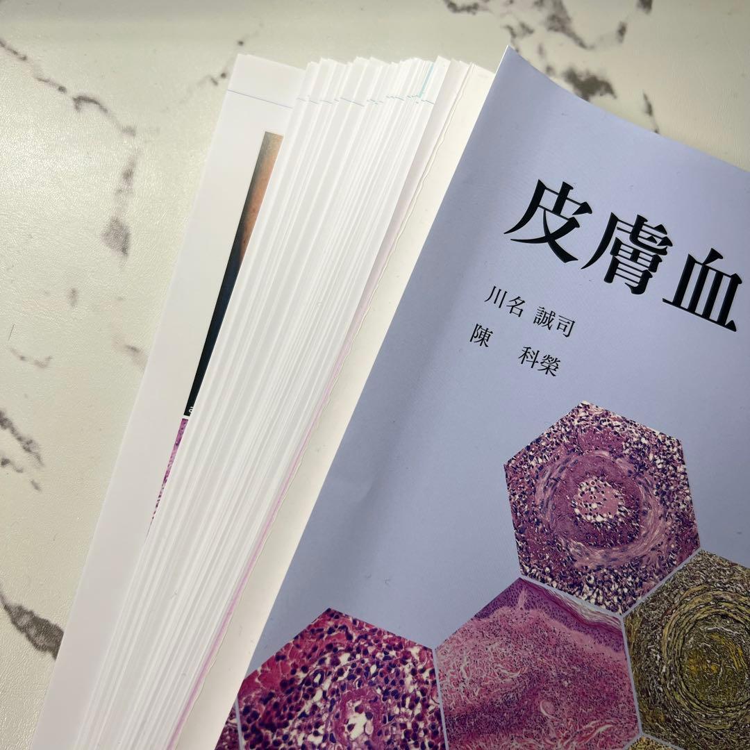 【裁断済み】皮膚血管炎