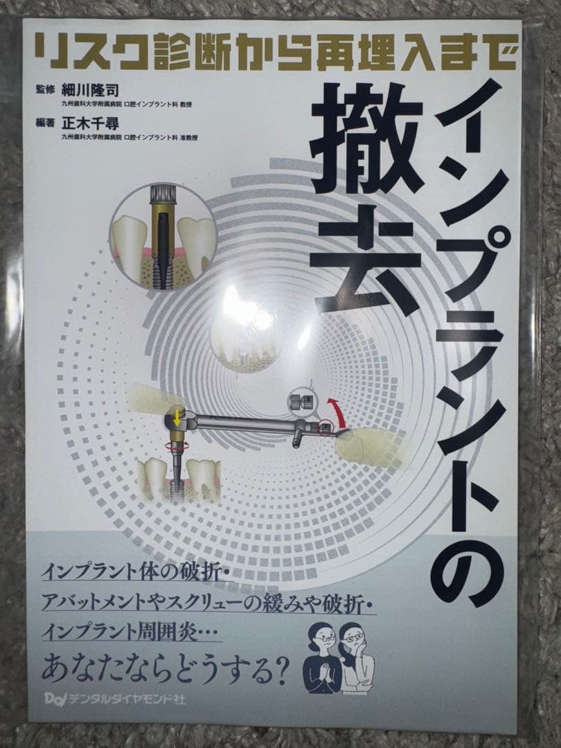 【裁断済み】インプラントの撤去　リスク診断から再埋入まで