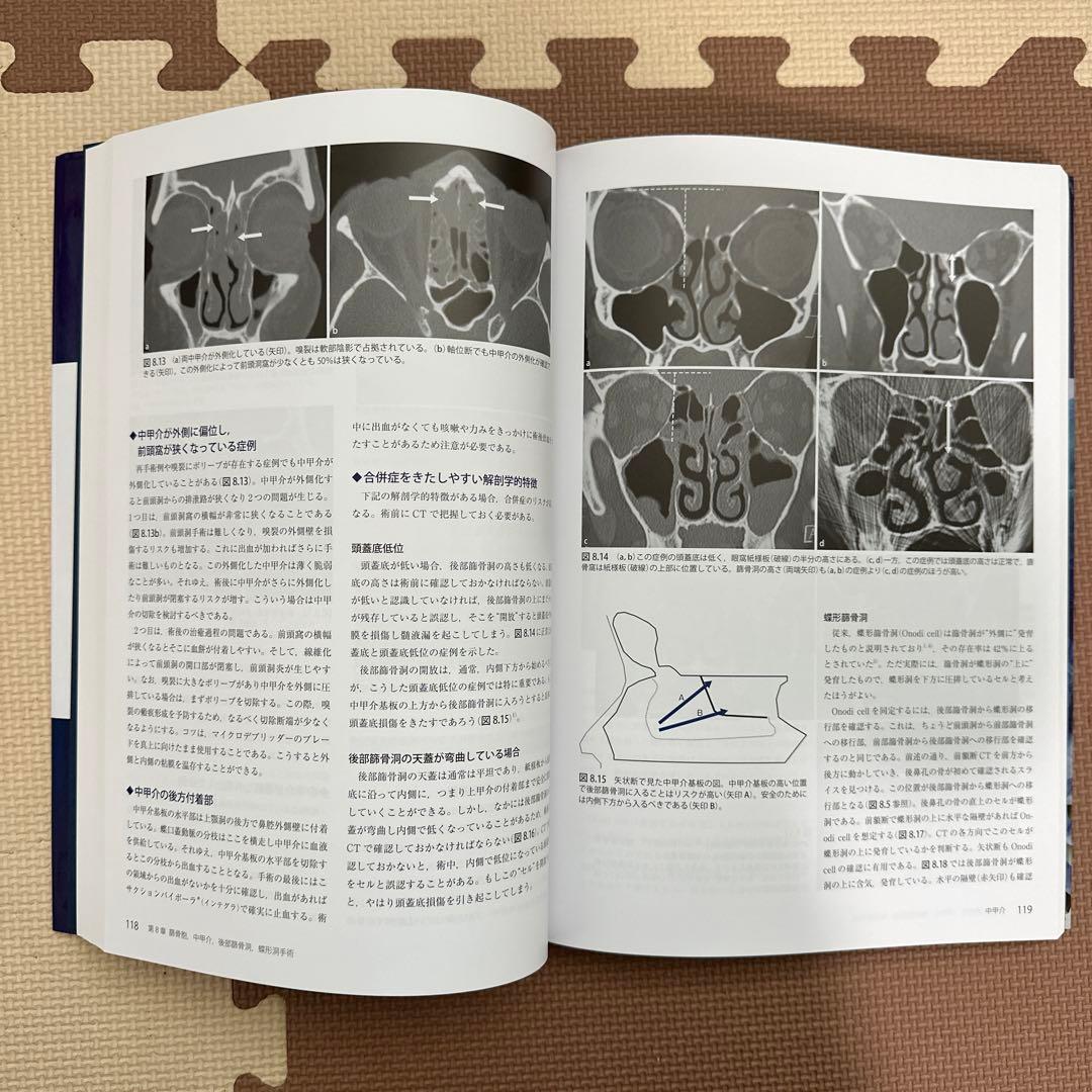 ウォーモルド内視鏡下鼻副鼻腔・頭蓋底手術