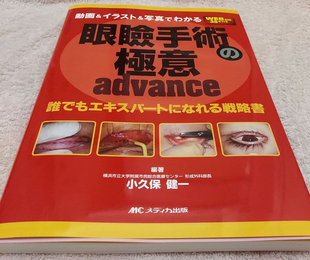 動画&イラスト&写真でわかる 眼瞼手術の極意 advance : 誰でもエキス…