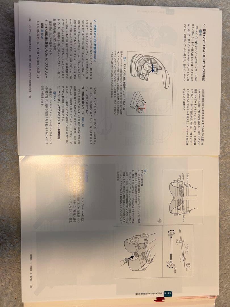 裁断済み　インプラント周囲骨折を極める
