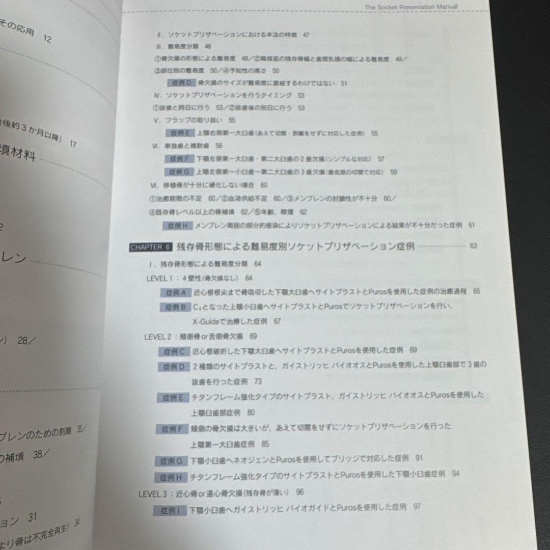 必ず上達 ソケットプリザベーション