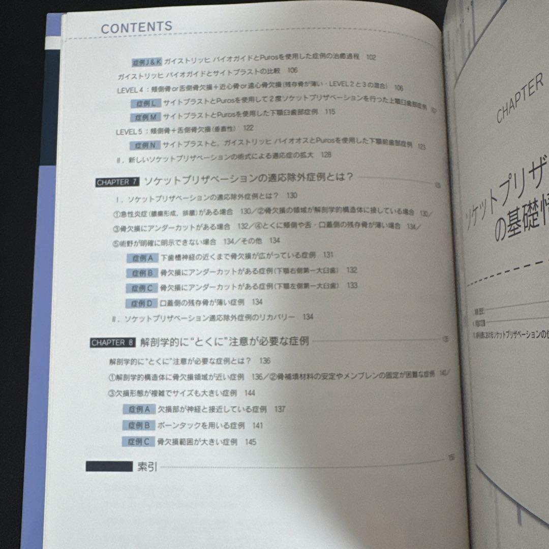 必ず上達 ソケットプリザベーション